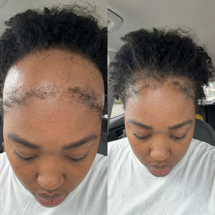 le Sérum Révolutionnaire pour la Repousse des Cheveux
