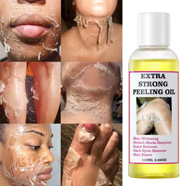 Extra Strong Peeling Oil – La Révélation pour une Peau Neuve en 3Jours