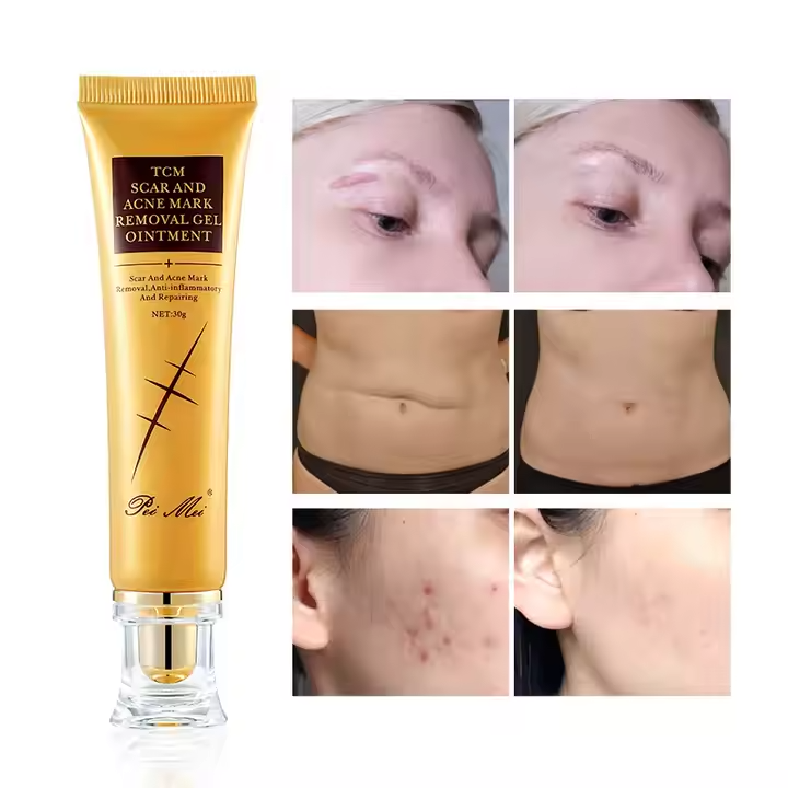 Anti-Cicatrices Ultra-Efficace – Élimine Cicatrices, Vergetures & Marques en Quelques Jours !