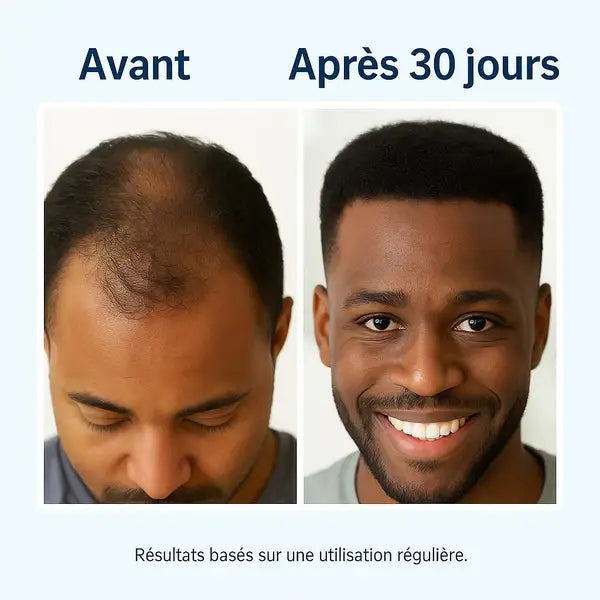 le Sérum Révolutionnaire pour la Repousse des Cheveux