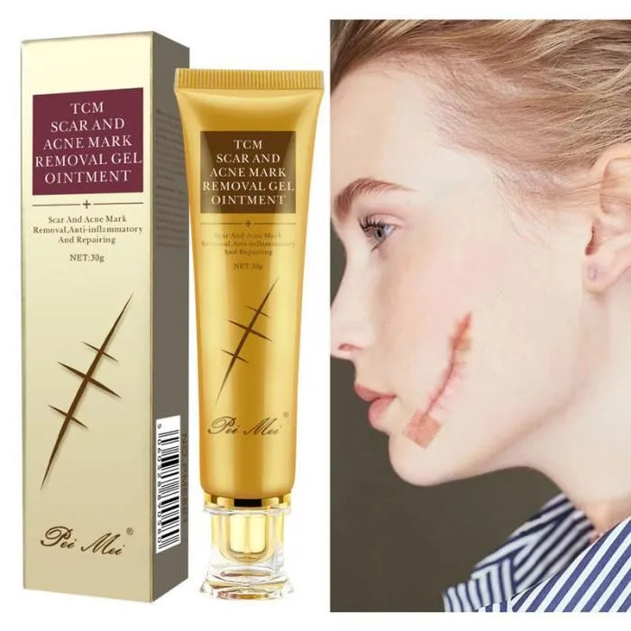 Anti-Cicatrices Ultra-Efficace – Élimine Cicatrices, Vergetures & Marques en Quelques Jours !