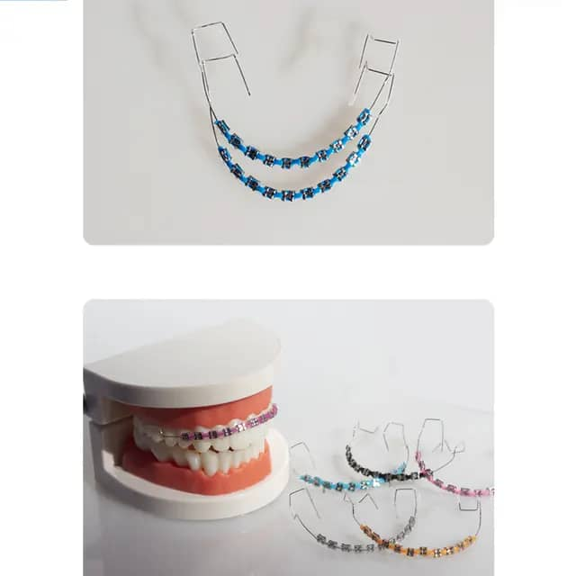 Appareil Dentaire Esthétique:Le Sourire Tendance qui Fait Craquer Tout le Monde