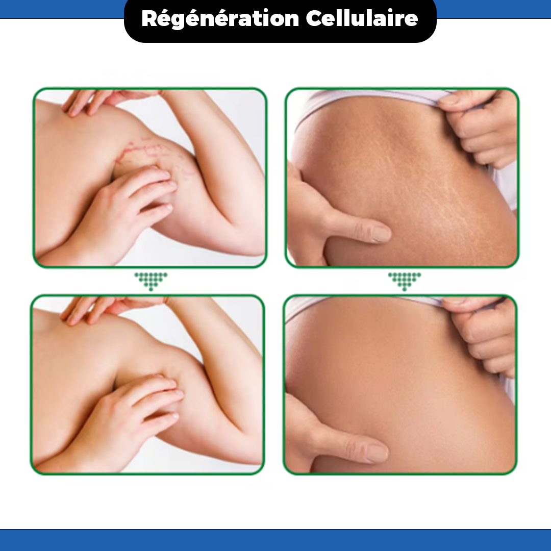 Crème Anti-Vergetures – Solution Réparatrice Premium