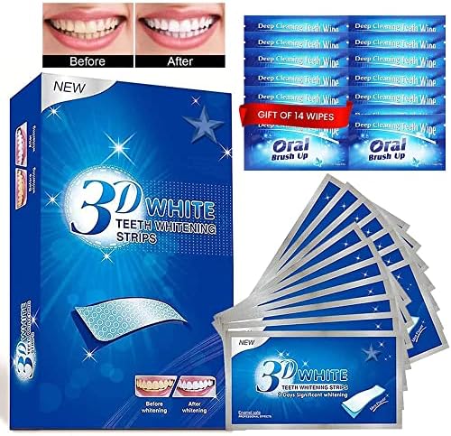 BANDES BLANCHISSANTES DENTS – SOURIRE BLANC EN 7 JOURS