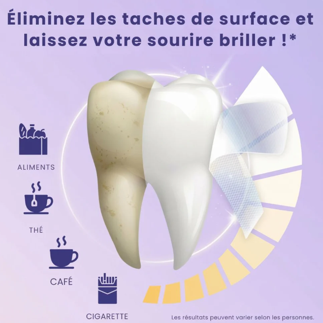 BANDES BLANCHISSANTES DENTS – SOURIRE BLANC EN 7 JOURS