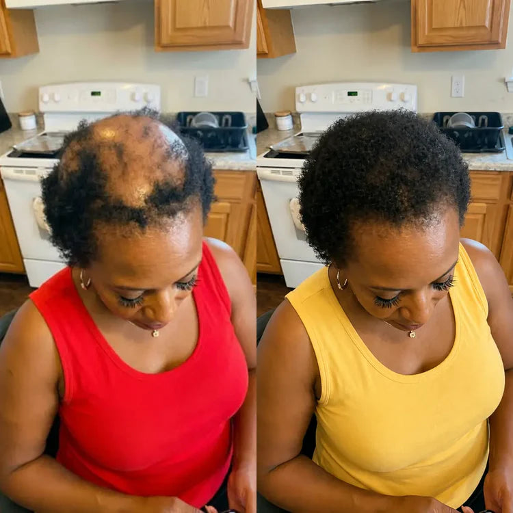 le Sérum Révolutionnaire pour la Repousse des Cheveux