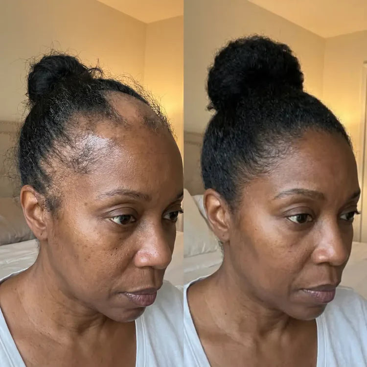 le Sérum Révolutionnaire pour la Repousse des Cheveux