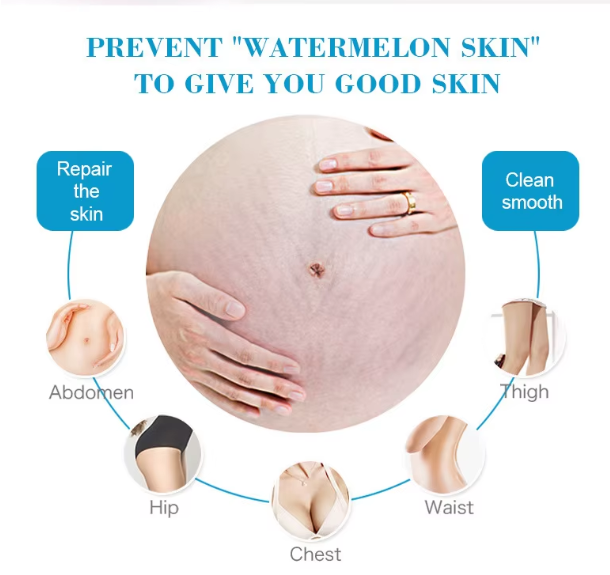 Crème Anti-Vergetures – Solution Réparatrice Premium